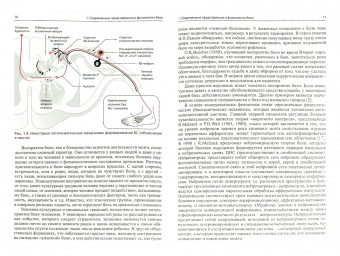 Живолупов, Самарцев: Малоинвазивная терапия (блокады) в неврологии
