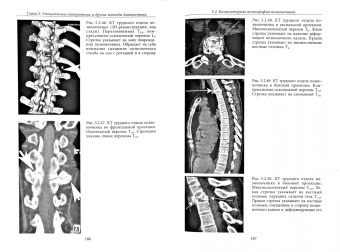Давыдов, Монашенко: Пособие по диагностике вертеброгенных заболеваний. Noli nocere