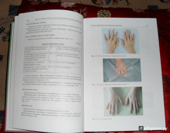 Геппе, Лыскина, Подчерняева: Руководство по детской ревматологии (+CD)