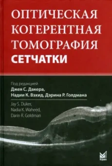 Оптическая когерентная томография сетчатки
