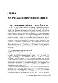 Камалов, Карпов, Шапаров: Эмболизация простатических артерий в лечении доброкачественной гиперплазии предстательной железы
