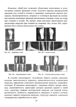 Н. Коновалова: Комплект из 4 плакатов. Профилактика плоскостопия у детей. ФГОС ДО