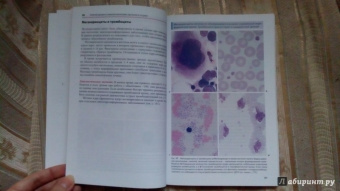 Тэмл, Диам, Хаверлах: Атлас по гематологии