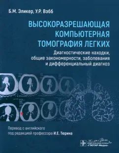 Эликер, Вэбб: Высокоразрешающая компьютерная томография легких. Диагностические находки, общие закономерности