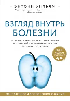 Энтони Уильям: Взгляд внутрь болезни. Все секреты хронических и таинственных заболеванийи способы их исцеления
