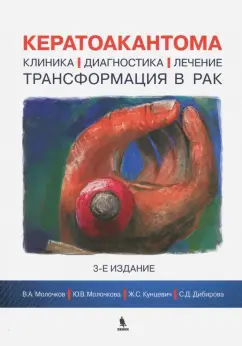 Молочков, Кунцевич, Молочкова: Кератоакантома. Клиника, диагностика, лечение, трансформация в рак