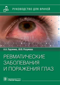Годзенко, Разумова: Ревматические заболевания и поражения глаз. Руководство для врачей