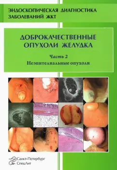 Добронец, Кузин, Шкалова: Доброкачественные опухоли желудка. Часть 2. Неэпителиальные опухоли