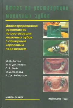 Даггел, Керзон, Фейл: Атлас по реставрации молочных зубов
