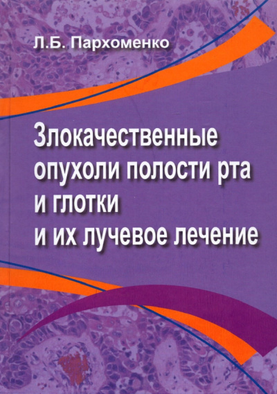 Лариса Пархоменко: Злокачественные опухоли полости рта и глотки и их лучевое лечение