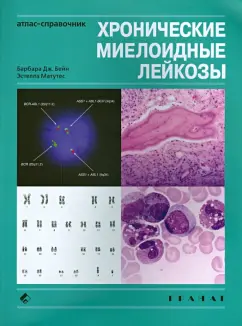 Бейн, Матутес: Хронические миелоидные лейкозы. Атлас-справочник