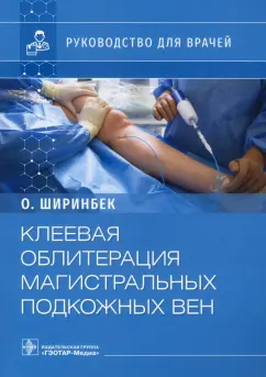 Олими Ширинбек: Клеевая облитерация магистральных подкожных вен. Руководство