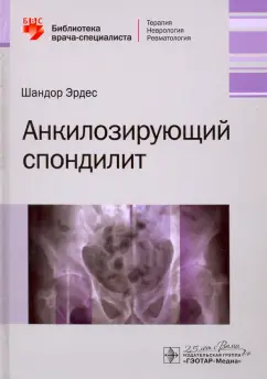 Шандор Эрдес: Анкилозирующий спондилит