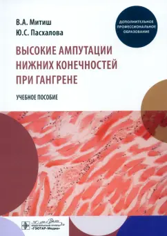 Митиш, Пасхалова: Высокие ампутации нижних конечностей при гангрене. Учебное пособие