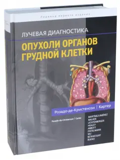 Розадо-де-Кристенсон, Картер: Лучевая диагностика. Опухоли органов грудной клетки
