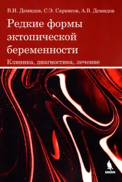 Демидов, Саркисов, Демидов: Редкие формы эктопической беременности. Клиника, диагностика, лечение