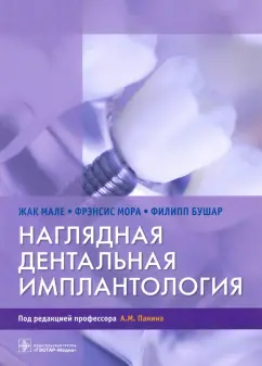 Мале, Мора, Бушар: Наглядная дентальная имплантология