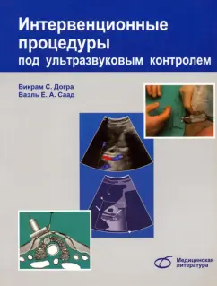 Догра, Монзер, Браун: Интервенционные процедуры под ультразвуковым контролем