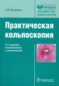 Светлана Роговская: Практическая кольпоскопия