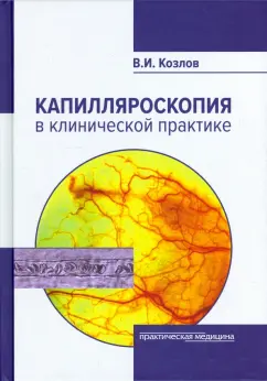 Валентин Козлов: Капилляроскопия в клинической практике. Монография