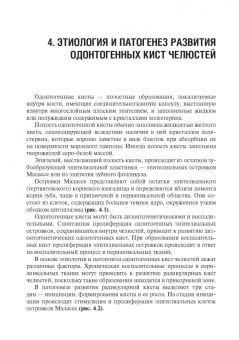 Базикян, Базикян, Чунихин: Одонтогенные кисты челюстей