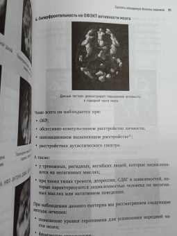 Дэниэл Амен: Конец психическим заболеваниям. Революционное исследование