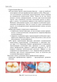 Марина Миронова: Стоматологические заболевания. Учебник