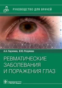 Годзенко, Разумова: Ревматические заболевания и поражения глаз. Руководство для врачей