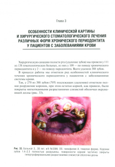 Дмитрий Шинкевич: Особенности стоматологической помощи больным с патологией системы крови