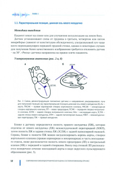 Васильев, Петрова, Шахов: Современная эхокардиографическая оценка состояния миокарда при ИБС