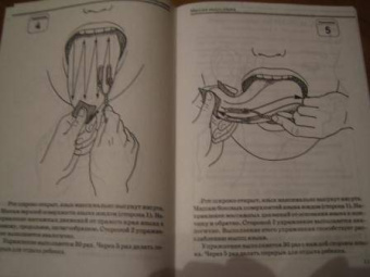 Елена Новикова: Зондовый массаж. Часть 4. Зонд №12 "Скользящий". Наглядно-практическое пособие