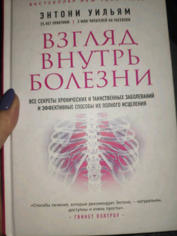 Энтони Уильям: Взгляд внутрь болезни. Все секреты хронических и таинственных заболеваний