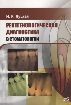 Ирина Луцкая: Рентгенологическая диагностика в стоматологии