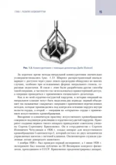 Шихвердиев, Хубулава: Кардиохирургический минимум для кардиологов
