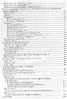 Ирина Луцкая: Рентгенологическая диагностика в стоматологии