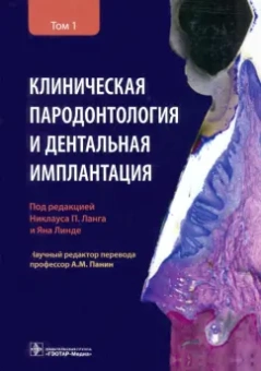 Ланг, Линде, Араудхо: Клиническая пародонтология и дентальная имплантация. В 2-х томах. Том 1