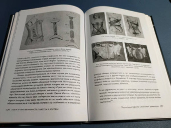 Каролин Дей: Чахоточный шик. История красоты, моды и недуга
