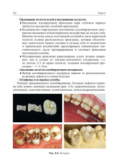 Марина Миронова: Стоматологические заболевания. Учебник