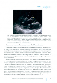 Васильев, Петрова, Шахов: Современная эхокардиографическая оценка состояния миокарда при ИБС