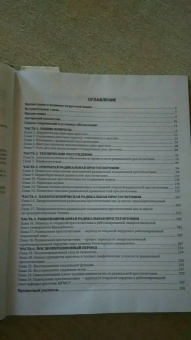 Радикальная простатэктомия
