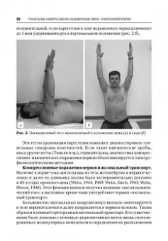 Александр Скоромец: Туннельные компрессионно-ишемические моно- и мультиневропатии