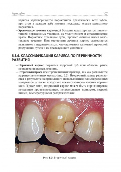 Марина Миронова: Стоматологические заболевания. Учебник