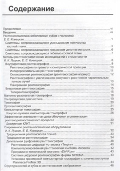 Ирина Луцкая: Рентгенологическая диагностика в стоматологии