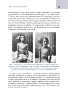 Шихвердиев, Хубулава: Кардиохирургический минимум для кардиологов
