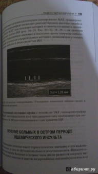 Кадыков, Манвелов, Шведков: Практическая неврология. Руководство для врачей
